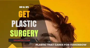 KJ Apa Plastic Surgery: Fact-Checking the Riverdale Star's Transformation
