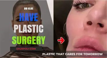 Did Khloé Kardashian Undergo Plastic Surgery? Unveiling the Truth