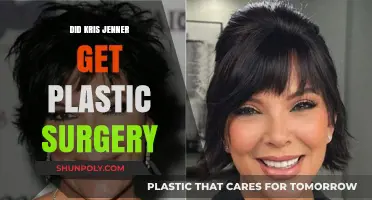 Kris Jenner's Transformation: Plastic Surgery Rumors and Reality Revealed