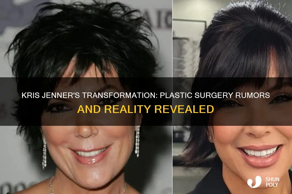 did kris jenner get plastic surgery