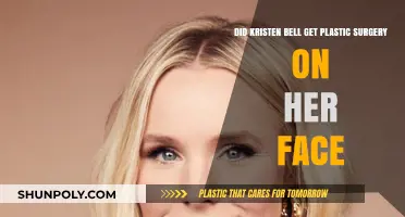 Kristen Bell's Face: Natural Beauty or Plastic Surgery Transformation?