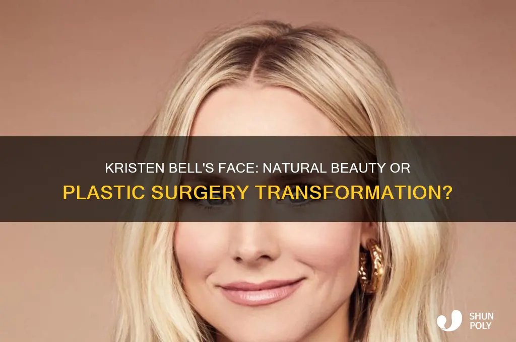 did kristen bell get plastic surgery on her face