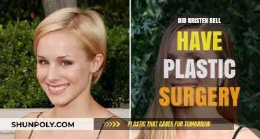 Kristen Bell's Transformation: Plastic Surgery Rumors Explored and Debunked