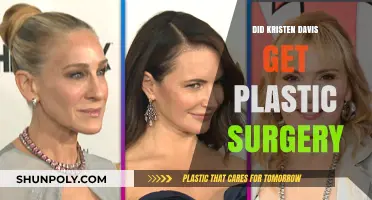 Kristen Davis Plastic Surgery: Fact-Checking the Rumors and Speculations
