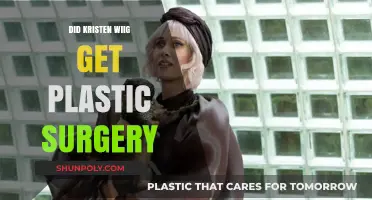 Kristen Wiig's Transformation: Plastic Surgery Rumors Explored and Debunked