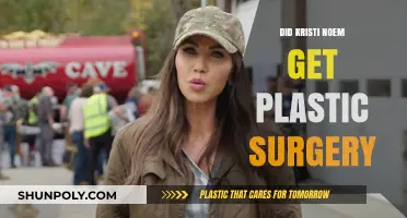Kristi Noem Plastic Surgery: Fact-Checking the Rumors and Speculations