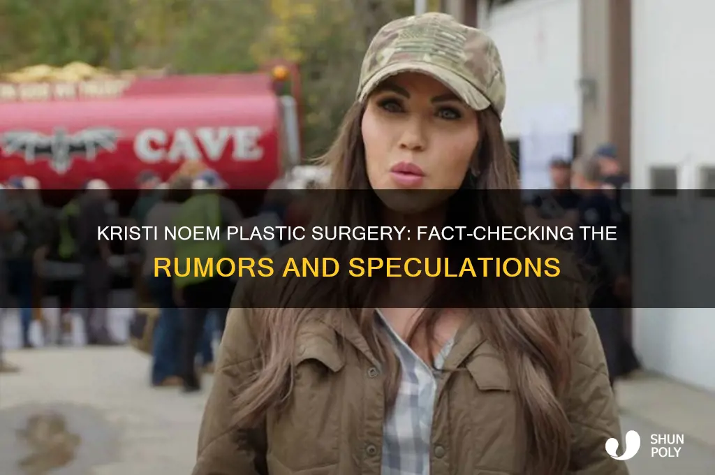 did kristi noem get plastic surgery
