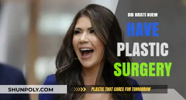 Kristi Noem Plastic Surgery Speculations: Fact-Checking the Rumors