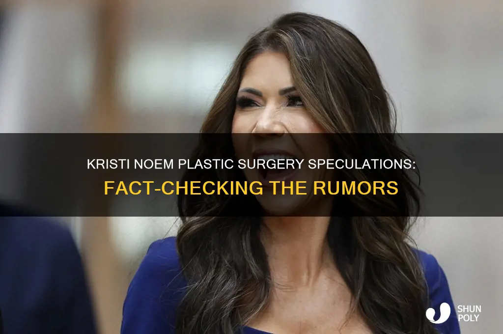 did kristi noem have plastic surgery