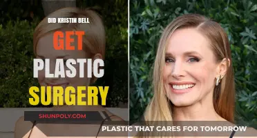 Kristin Bell's Transformation: Plastic Surgery Rumors Explored and Debunked