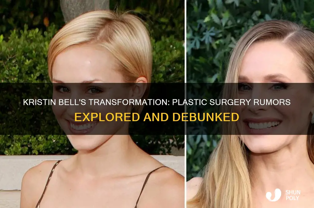 did kristin bell get plastic surgery