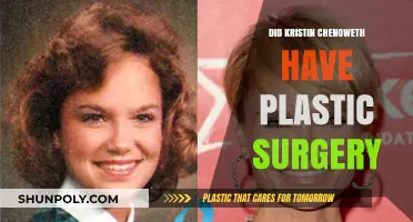 Kristin Chenoweth's Transformation: Plastic Surgery Speculations and Truths
