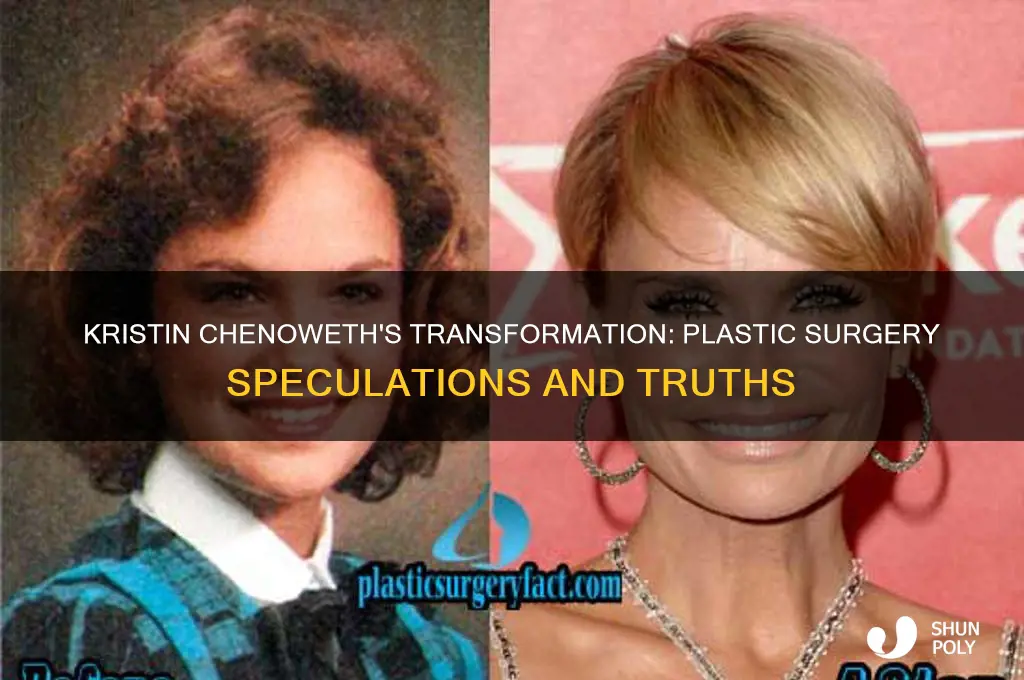 did kristin chenoweth have plastic surgery