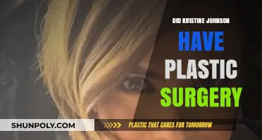 Kristine Johnson's Transformation: Plastic Surgery Speculations and Truths