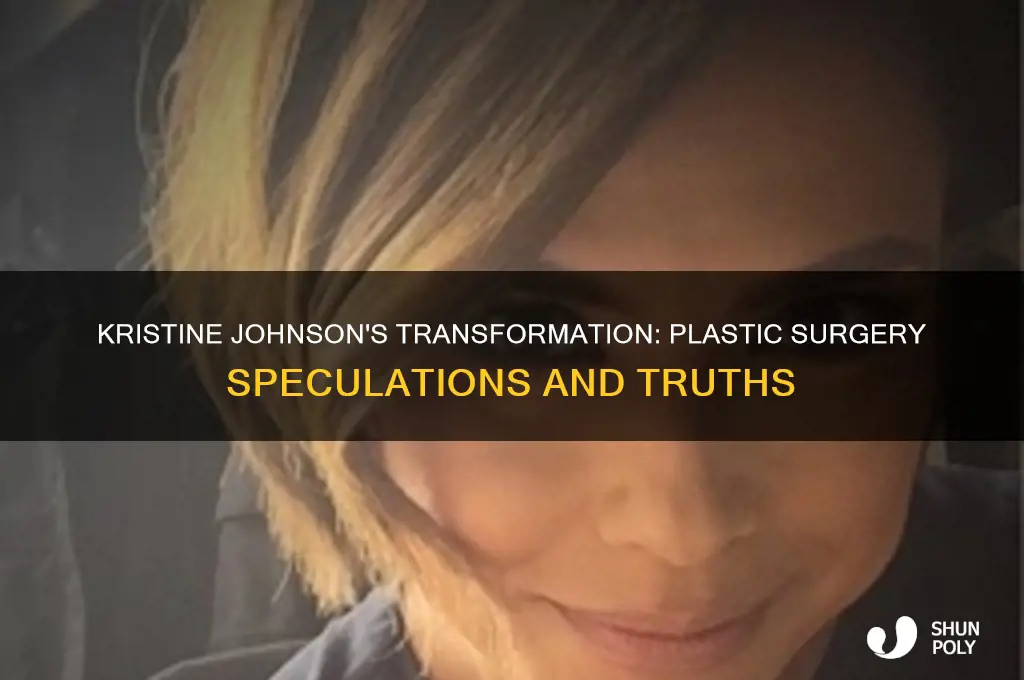 did kristine johnson have plastic surgery