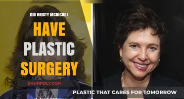 Kristy McNichol's Transformation: Plastic Surgery Rumors Explored