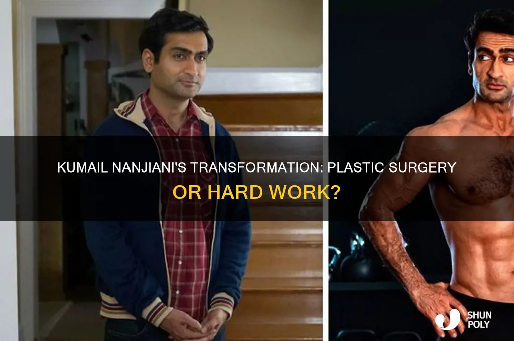 did kumail nanjiani get plastic surgery