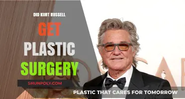 Kurt Russell's Changing Looks: Plastic Surgery Rumors Explored