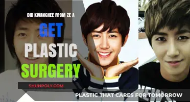 Kwanghee's Transformation: Plastic Surgery Rumors and the Truth Revealed