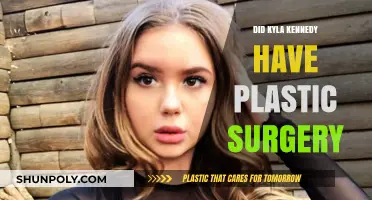 Kyla Kennedy Plastic Surgery: Fact-Checking the Rumors and Speculations