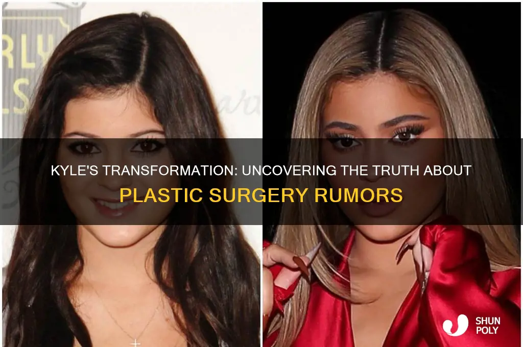 did kyle get plastic surgery
