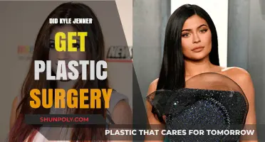 Did Kylie Jenner Undergo Plastic Surgery? Unveiling the Truth Behind Her Transformation