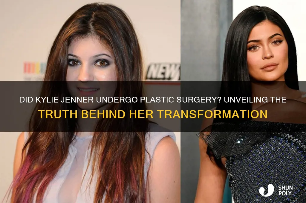 did kyle jenner get plastic surgery