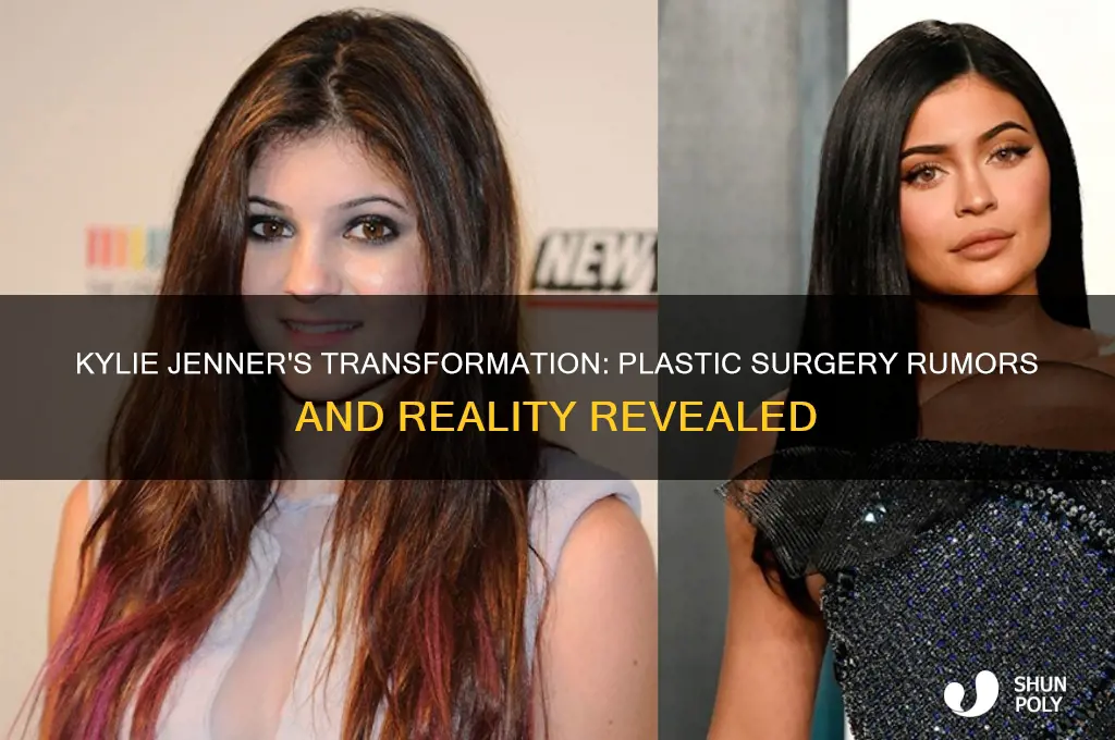 did kylie do plastic surgery