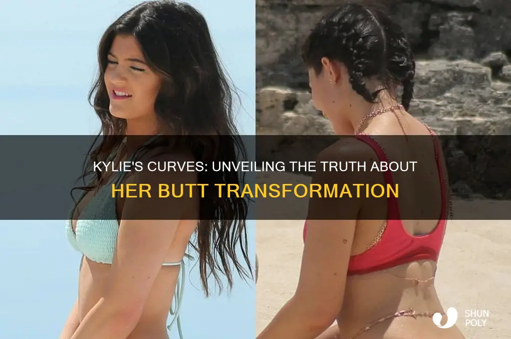 did kylie get plastic surgery on butt