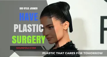 Kylie Jenner's Transformation: Plastic Surgery Rumors and Reality Revealed