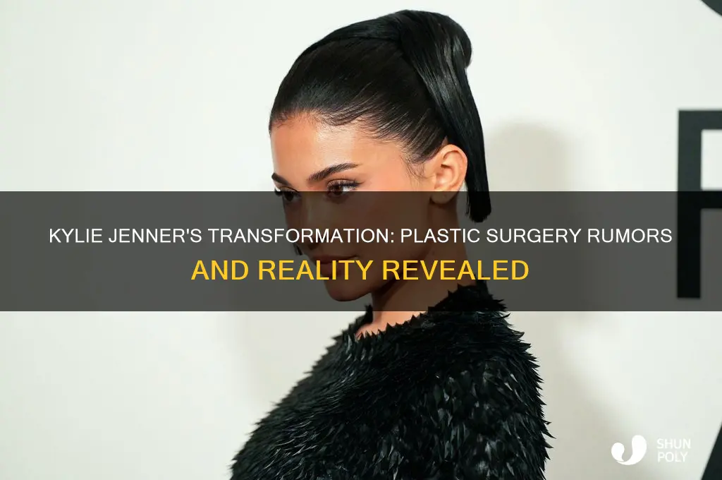did kylie jenner have plastic surgery
