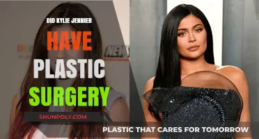 Kylie Jenner's Transformation: Plastic Surgery Rumors and Reality Revealed