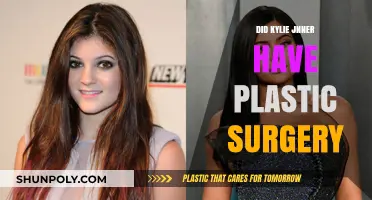 Kylie Jenner's Transformation: Plastic Surgery Rumors and Reality Revealed