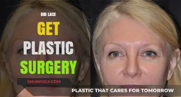 Did Lace Undergo Plastic Surgery? Unveiling the Truth Behind Her Transformation
