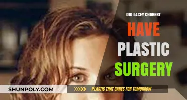 Lacey Chabert's Transformation: Plastic Surgery Rumors Explored and Debunked