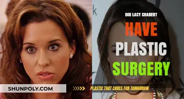 Lacy Chabert Plastic Surgery: Fact-Checking Her Transformation Rumors