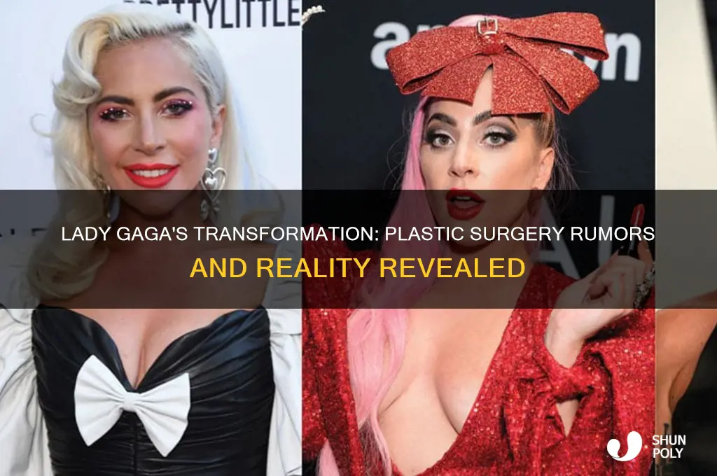 did lady gaga did plastic surgery