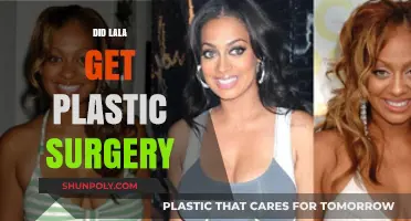 Lala's Transformation: Uncovering the Truth About Plastic Surgery Rumors