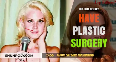 Lana Del Rey's Transformation: Plastic Surgery Speculations and Truths