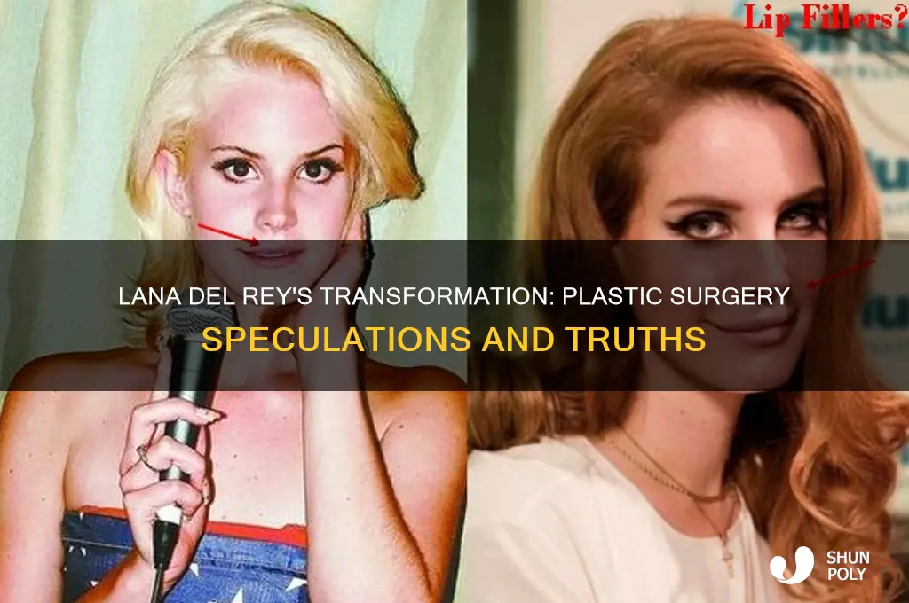 did lana del ray have plastic surgery