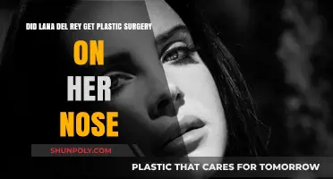 Lana Del Rey's Nose Transformation: Plastic Surgery Speculations Explored