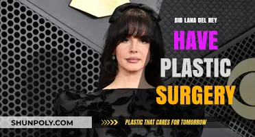 Lana Del Rey's Transformation: Plastic Surgery Rumors Explored