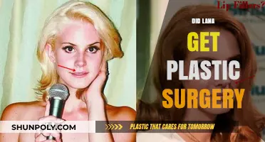 Did Lana Del Rey Undergo Plastic Surgery? Unraveling the Truth