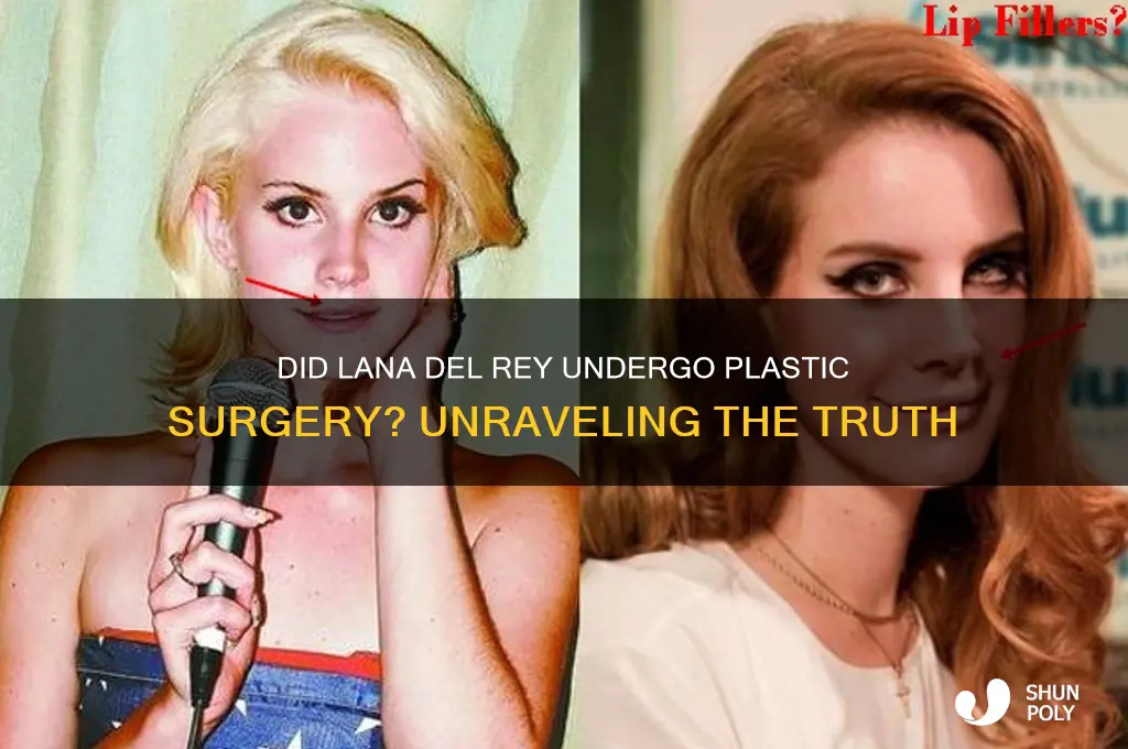 did lana get plastic surgery