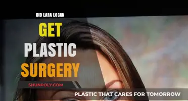 Lara Logan Plastic Surgery: Fact-Checking the Transformation Rumors