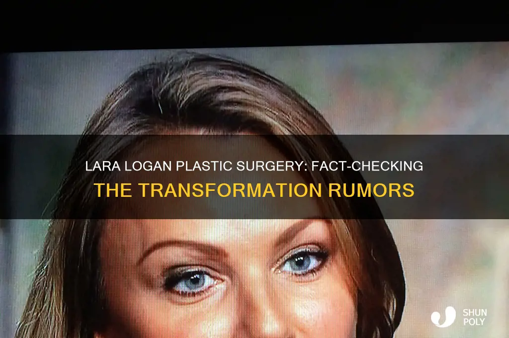 did lara logan get plastic surgery