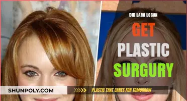 Lara Logan Plastic Surgery: Fact or Fiction? Uncovering the Truth