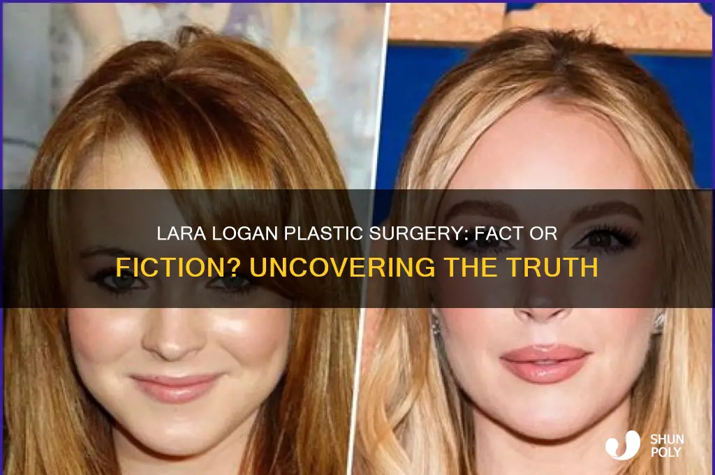 did lara logan get plastic surgury