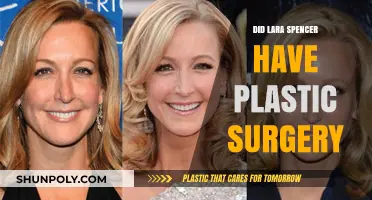 Lara Spencer Plastic Surgery: Fact-Checking the Rumors and Speculations