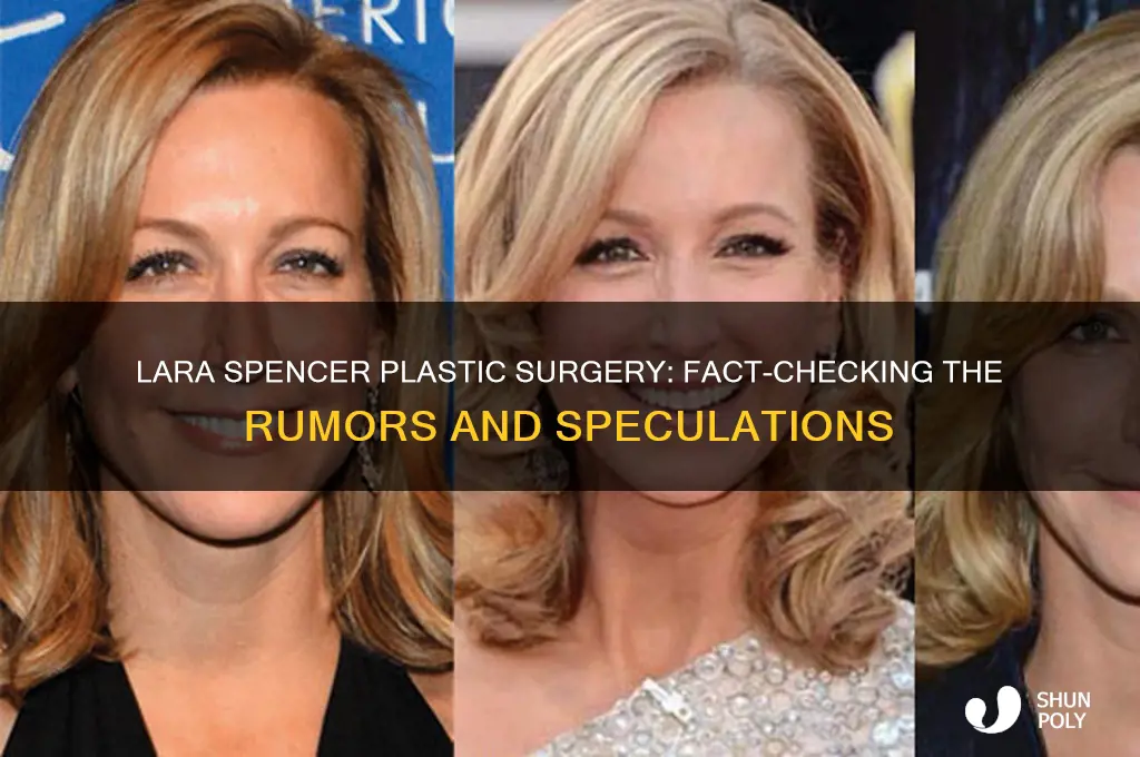 did lara spencer have plastic surgery